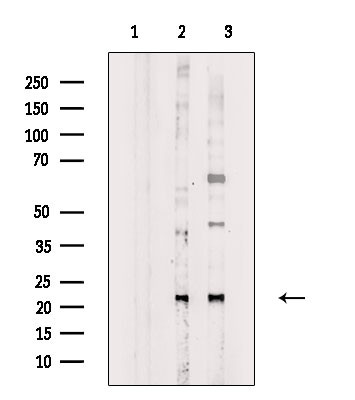 Phospho-SAR1A (Thr139) Antibody in Western Blot (WB)