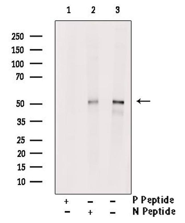 Phospho-Naked2 (Tyr247) Antibody in Western Blot (WB)