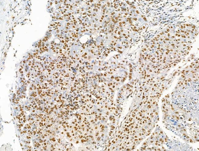 Acetyl-p53 (Lys373) Antibody in Immunohistochemistry (Paraffin) (IHC (P))