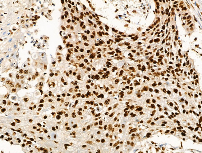 Acetyl-p53 (Lys373) Antibody in Immunohistochemistry (Paraffin) (IHC (P))