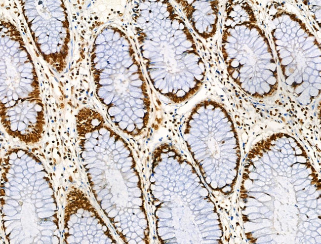 Acetyl-p53 (Lys373) Antibody in Immunohistochemistry (Paraffin) (IHC (P))