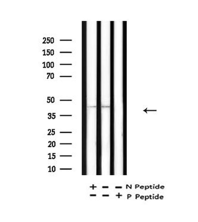 Acetyl-p53 (Lys381) Antibody in Western Blot (WB)