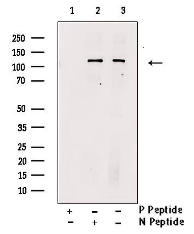 Phospho-ULK1 (Ser638) Antibody in Western Blot (WB)