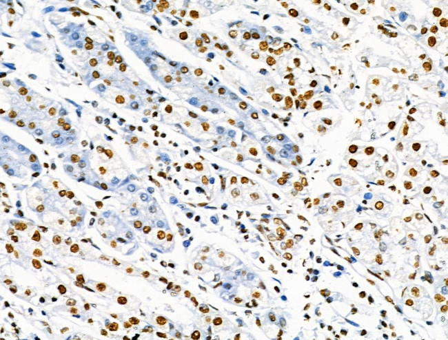 Phospho-SRF (Ser103) Antibody in Immunohistochemistry (Paraffin) (IHC (P))