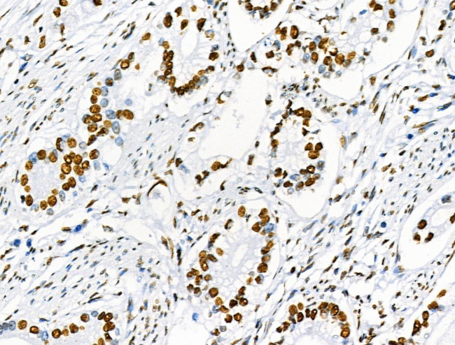 Phospho-SRF (Ser103) Antibody in Immunohistochemistry (Paraffin) (IHC (P))