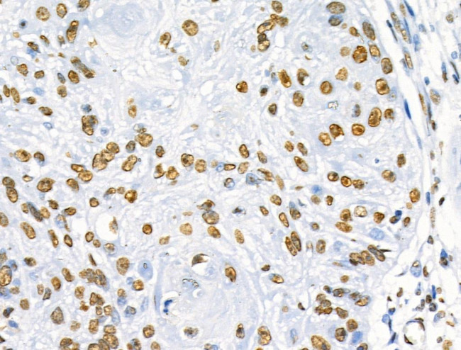 Phospho-SRF (Ser103) Antibody in Immunohistochemistry (Paraffin) (IHC (P))