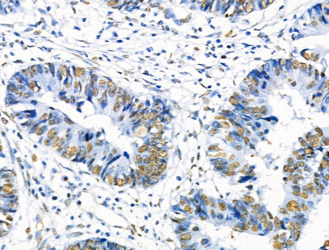 Phospho-SRF (Ser103) Antibody in Immunohistochemistry (Paraffin) (IHC (P))