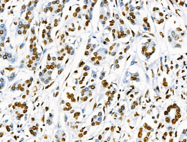 Phospho-SRF (Ser103) Antibody in Immunohistochemistry (Paraffin) (IHC (P))