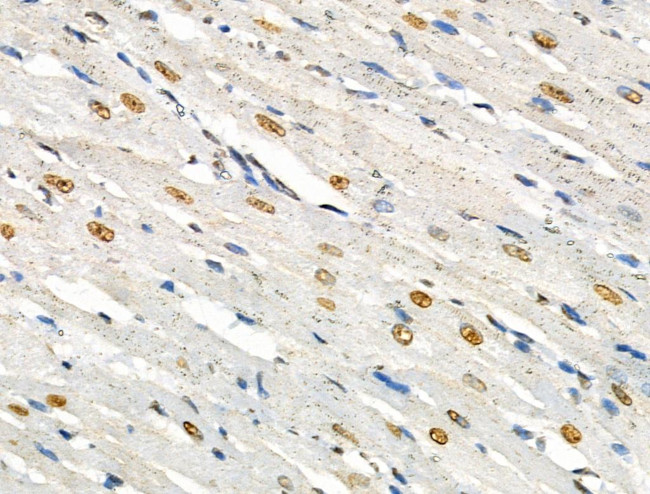 Phospho-SRF (Ser103) Antibody in Immunohistochemistry (Paraffin) (IHC (P))