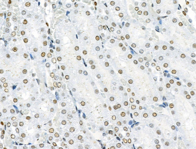 Phospho-SRF (Ser103) Antibody in Immunohistochemistry (Paraffin) (IHC (P))