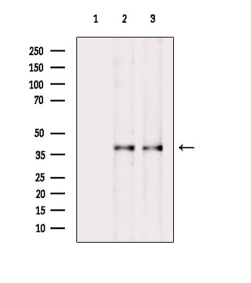 Phospho-Fra1 (Ser265) Antibody in Western Blot (WB)