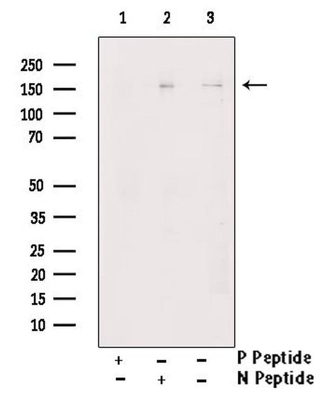 Phospho-RASGRF1 (Ser927) Antibody in Western Blot (WB)