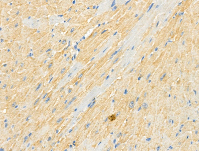 Phospho-RASGRF1 (Ser927) Antibody in Immunohistochemistry (Paraffin) (IHC (P))