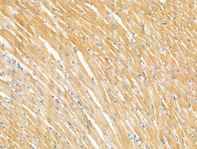 Phospho-RASGRF1 (Ser927) Antibody in Immunohistochemistry (Paraffin) (IHC (P))