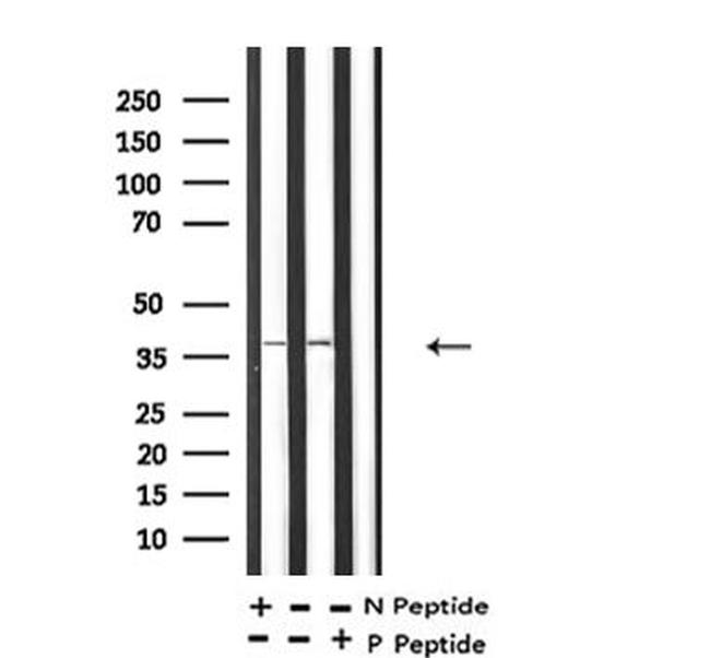 Phospho-MKP-1 (Ser359) Antibody in Western Blot (WB)