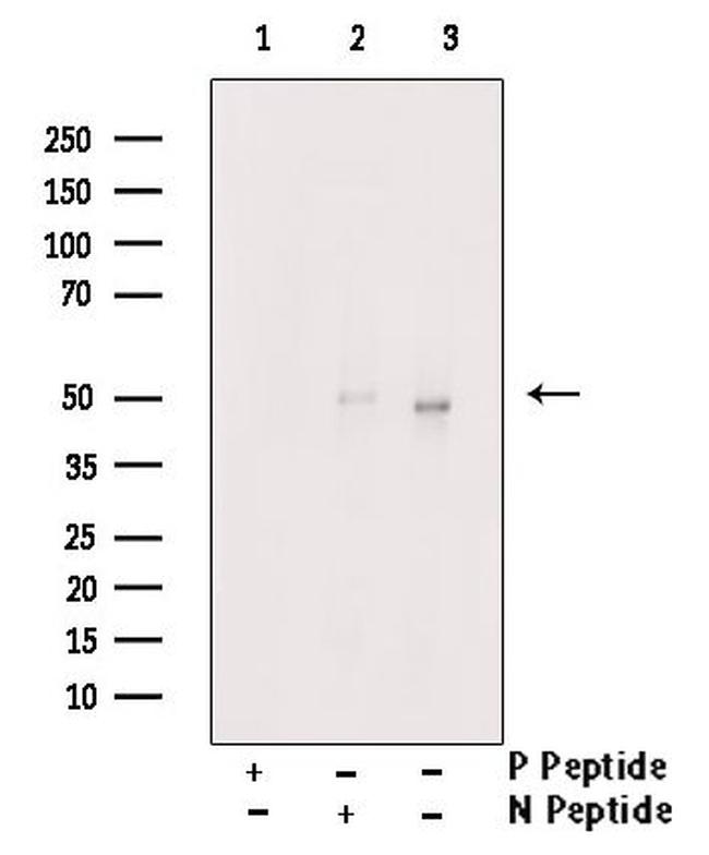 Phospho-OPRM1 (Ser377) Antibody in Western Blot (WB)