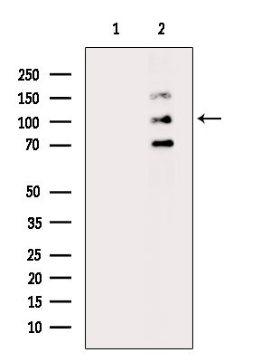 Phospho-SREBP1 (Ser396) Antibody in Western Blot (WB)