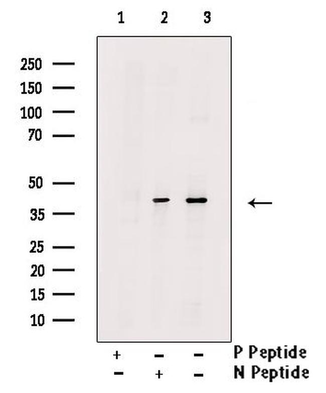 Phospho-TOB1 (Ser164) Antibody in Western Blot (WB)