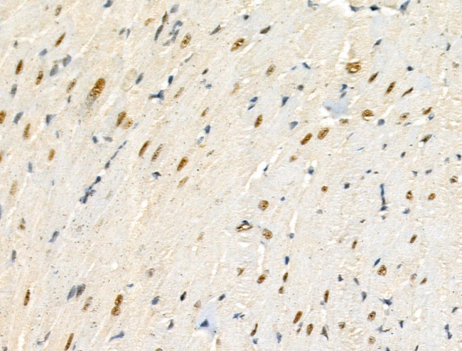 Phospho-TOB1 (Ser164) Antibody in Immunohistochemistry (Paraffin) (IHC (P))