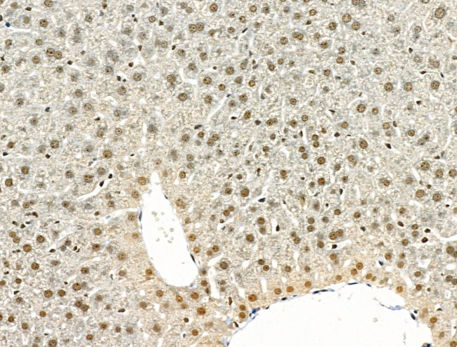 Phospho-TOB1 (Ser164) Antibody in Immunohistochemistry (Paraffin) (IHC (P))