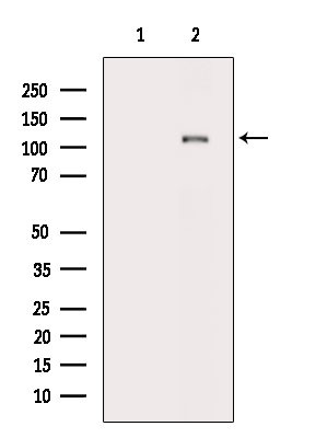 Phospho-PLD1 (Thr147) Antibody in Western Blot (WB)