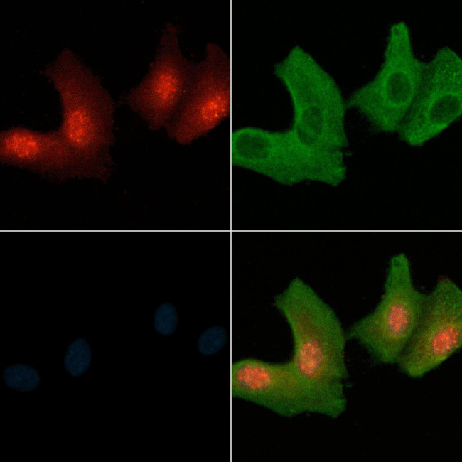 Phospho-ErbB4 (Tyr984) Antibody in Immunocytochemistry (ICC/IF)