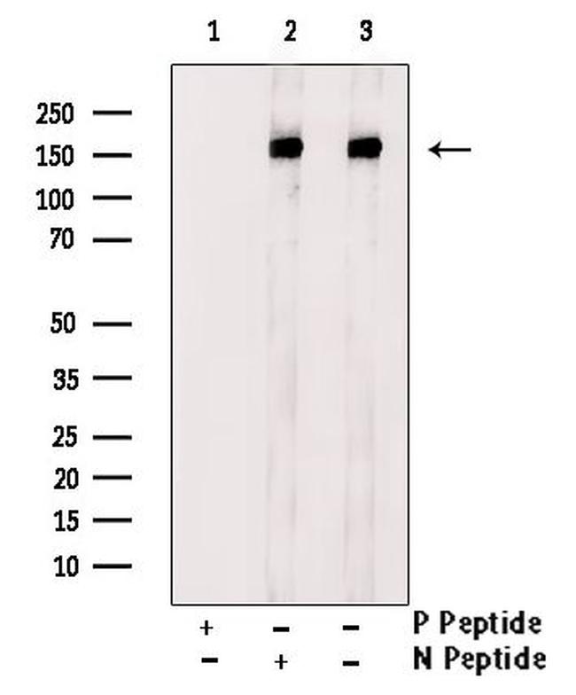 Phospho-ErbB4 (Tyr984) Antibody in Western Blot (WB)
