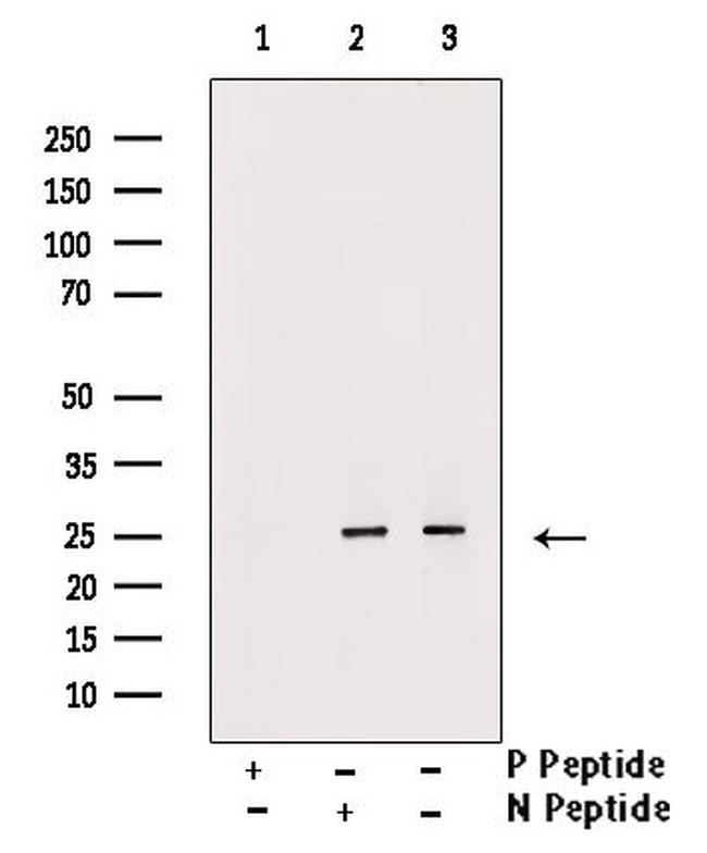 Phospho-MOB4A (Thr35) Antibody in Western Blot (WB)