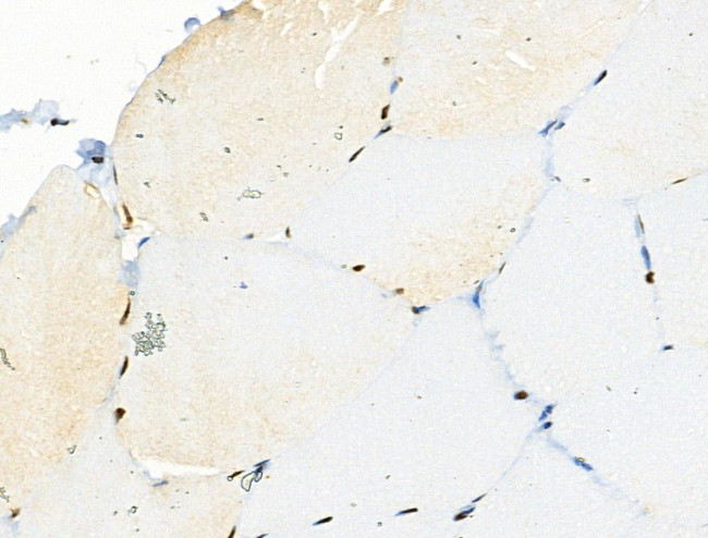 Phospho-PAR4 (Thr163) Antibody in Immunohistochemistry (Paraffin) (IHC (P))