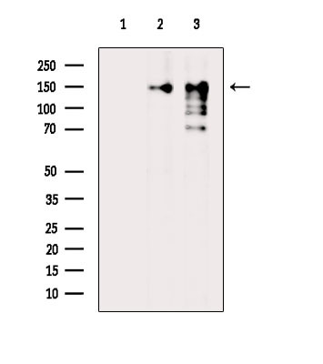 Phospho-CARD11 (Ser652) Antibody in Western Blot (WB)