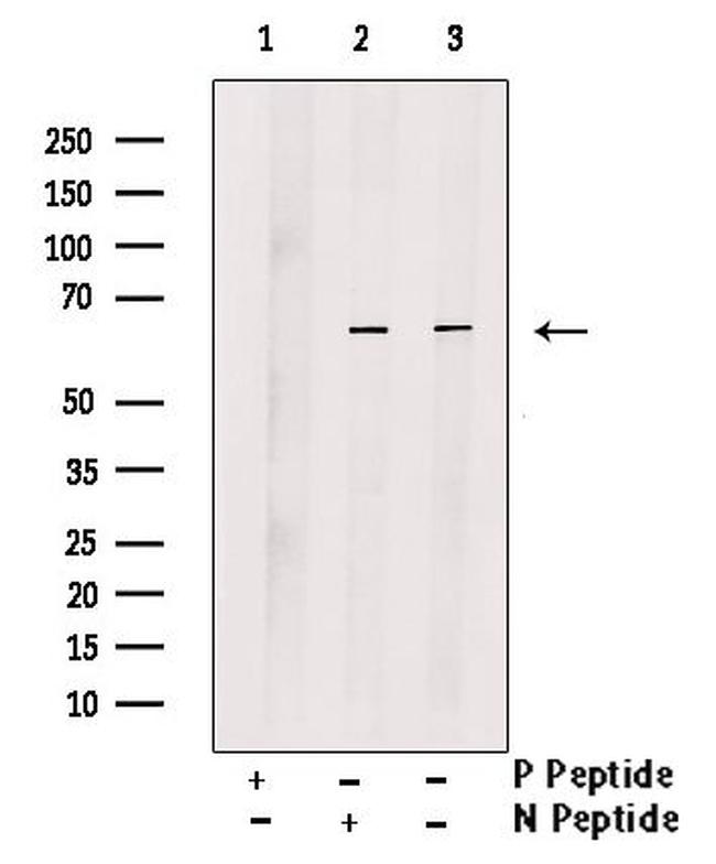 Phospho-PINK1 (Thr313) Antibody in Western Blot (WB)