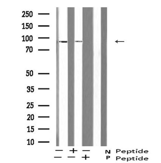 Phospho-ATRIP (Ser224) Antibody in Western Blot (WB)