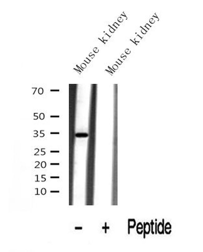 KHK (Isoform A) Antibody in Western Blot (WB)
