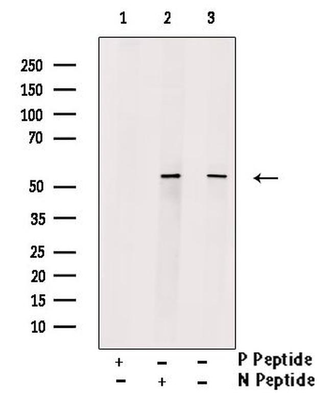 Phospho-N-WASP (Tyr256) Antibody in Western Blot (WB)