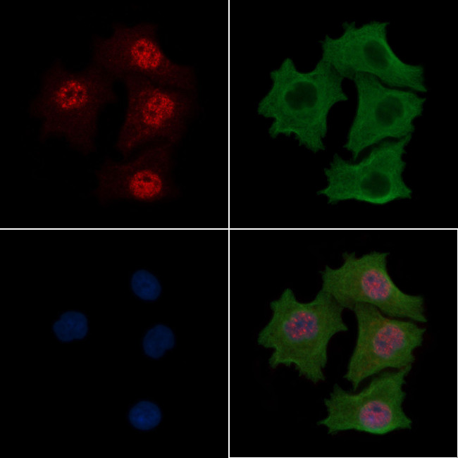 Phospho-CDK20 (Thr161) Antibody in Immunocytochemistry (ICC/IF)