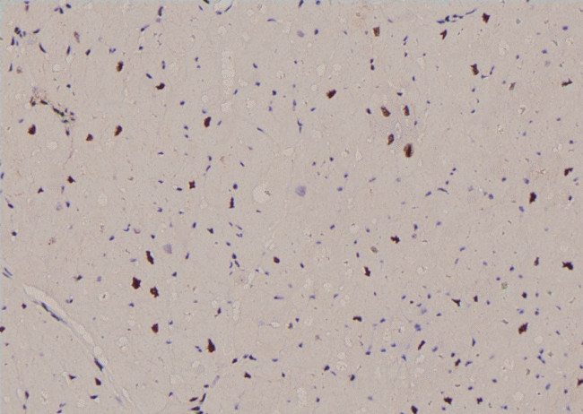 Phospho-CDK20 (Thr161) Antibody in Immunohistochemistry (Paraffin) (IHC (P))