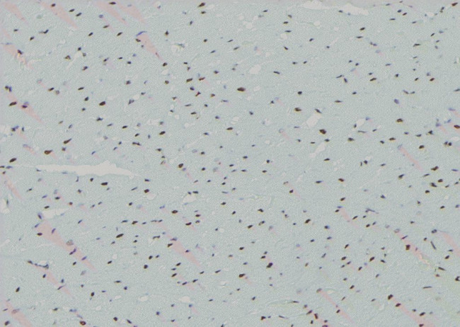 Phospho-CDK20 (Thr161) Antibody in Immunohistochemistry (Paraffin) (IHC (P))