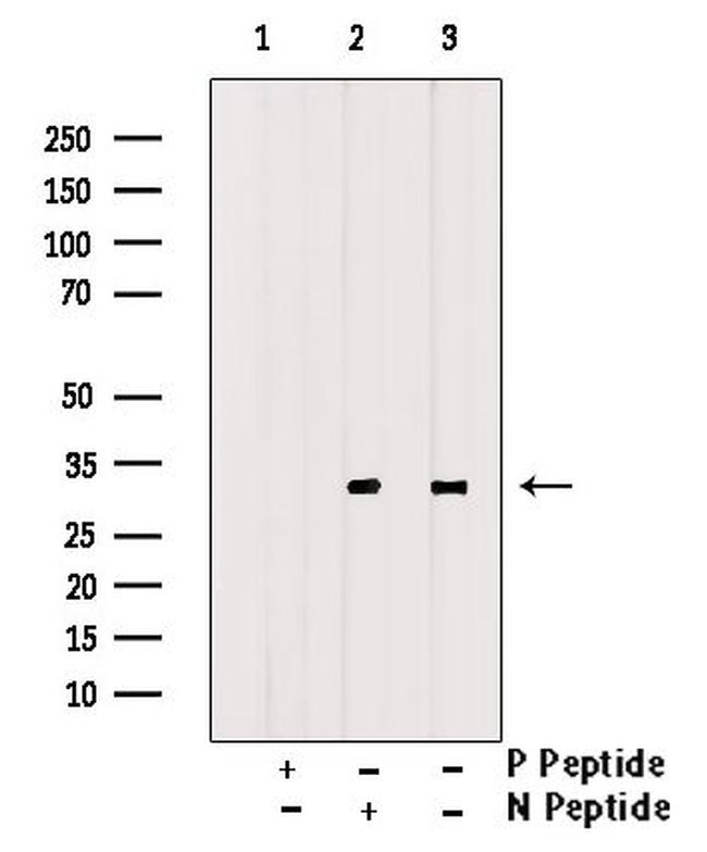 Phospho-CDK20 (Thr161) Antibody in Western Blot (WB)