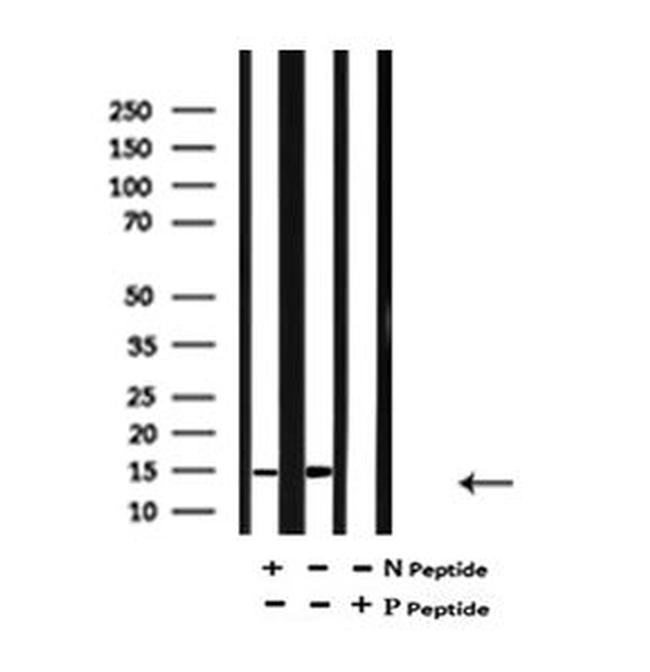 Phospho-FABP7 (Thr117) Antibody in Western Blot (WB)