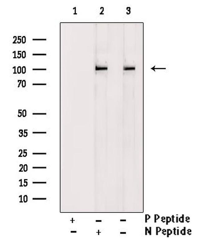 Phospho-HCN1 (Ser846) Antibody in Western Blot (WB)