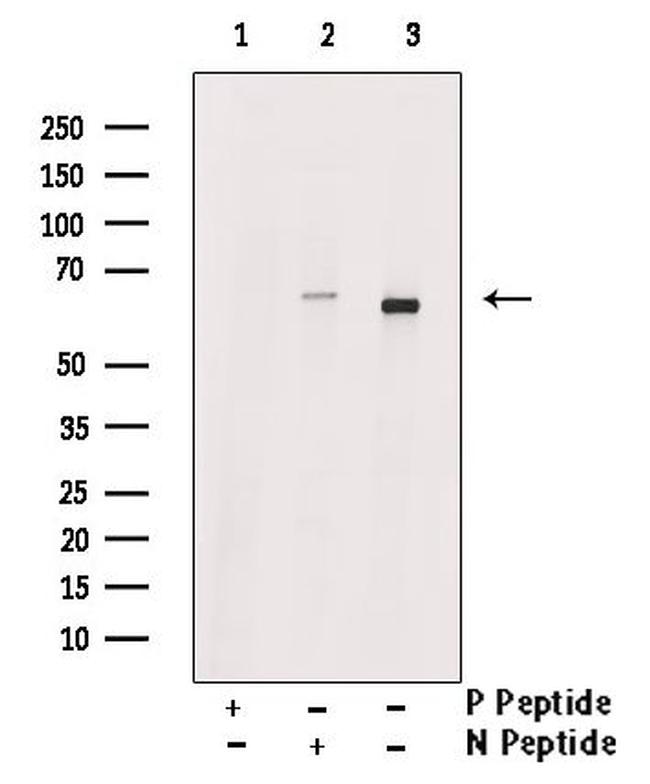 Phospho-SLC22A8 (Ser4) Antibody in Western Blot (WB)