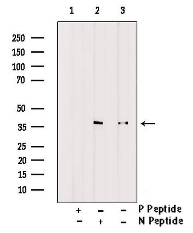 Phospho-FBP1 (Tyr265) Antibody in Western Blot (WB)