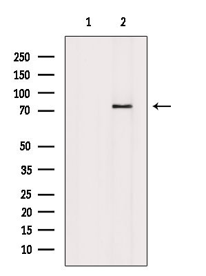 Phospho-RIP1 (Tyr384) Antibody in Western Blot (WB)