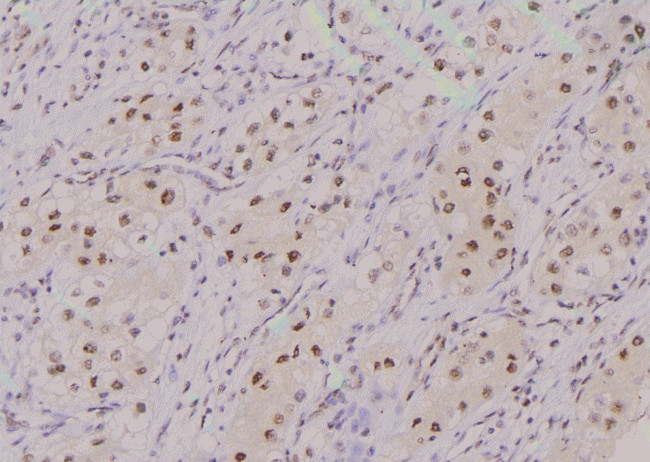 Phospho-BACH1 (Ser445) Antibody in Immunohistochemistry (Paraffin) (IHC (P))