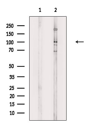 Phospho-SEMA4B (Ser809) Antibody in Western Blot (WB)