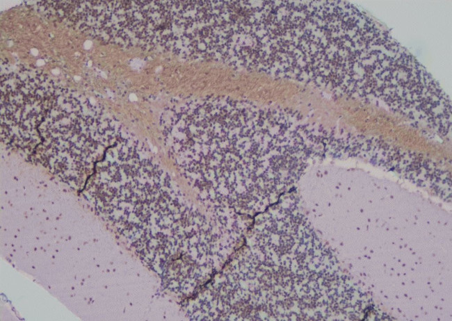 Phospho-SHIP2 (Tyr671) Antibody in Immunohistochemistry (Paraffin) (IHC (P))