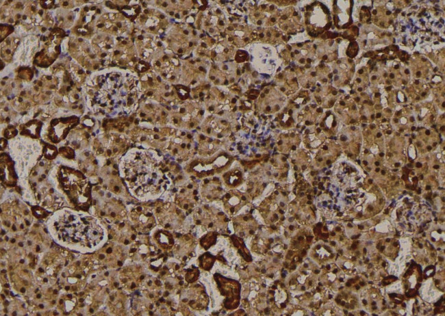 Phospho-RIP2 (Ser531) Antibody in Immunohistochemistry (Paraffin) (IHC (P))