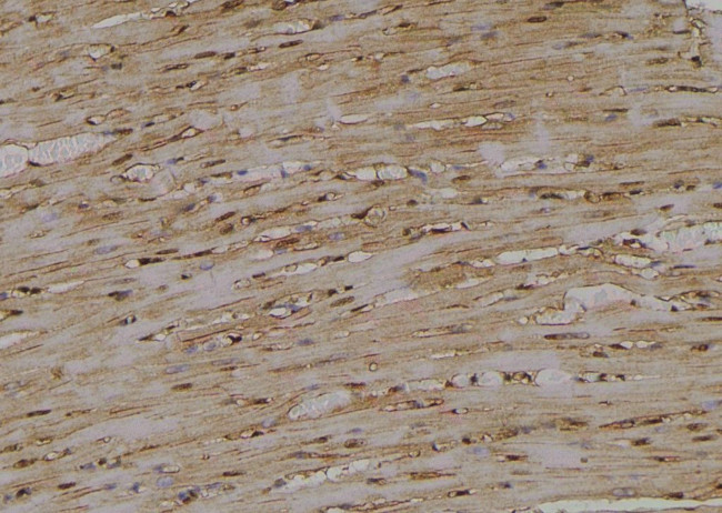 Phospho-RIP2 (Ser531) Antibody in Immunohistochemistry (Paraffin) (IHC (P))