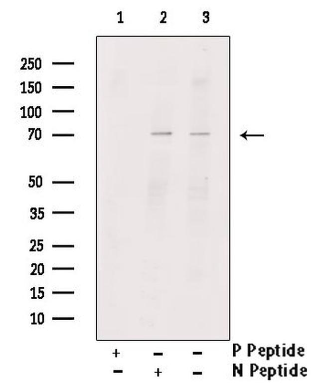 Phospho-RIP2 (Ser531) Antibody in Western Blot (WB)