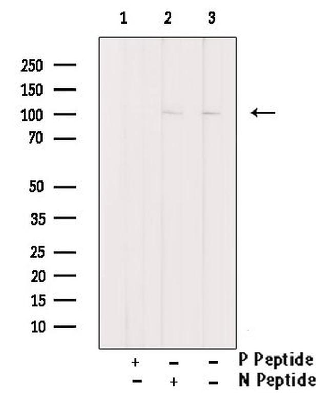 Phospho-FoxO3a (Ser644) Antibody in Western Blot (WB)